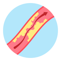 an illustration of Cholesterol